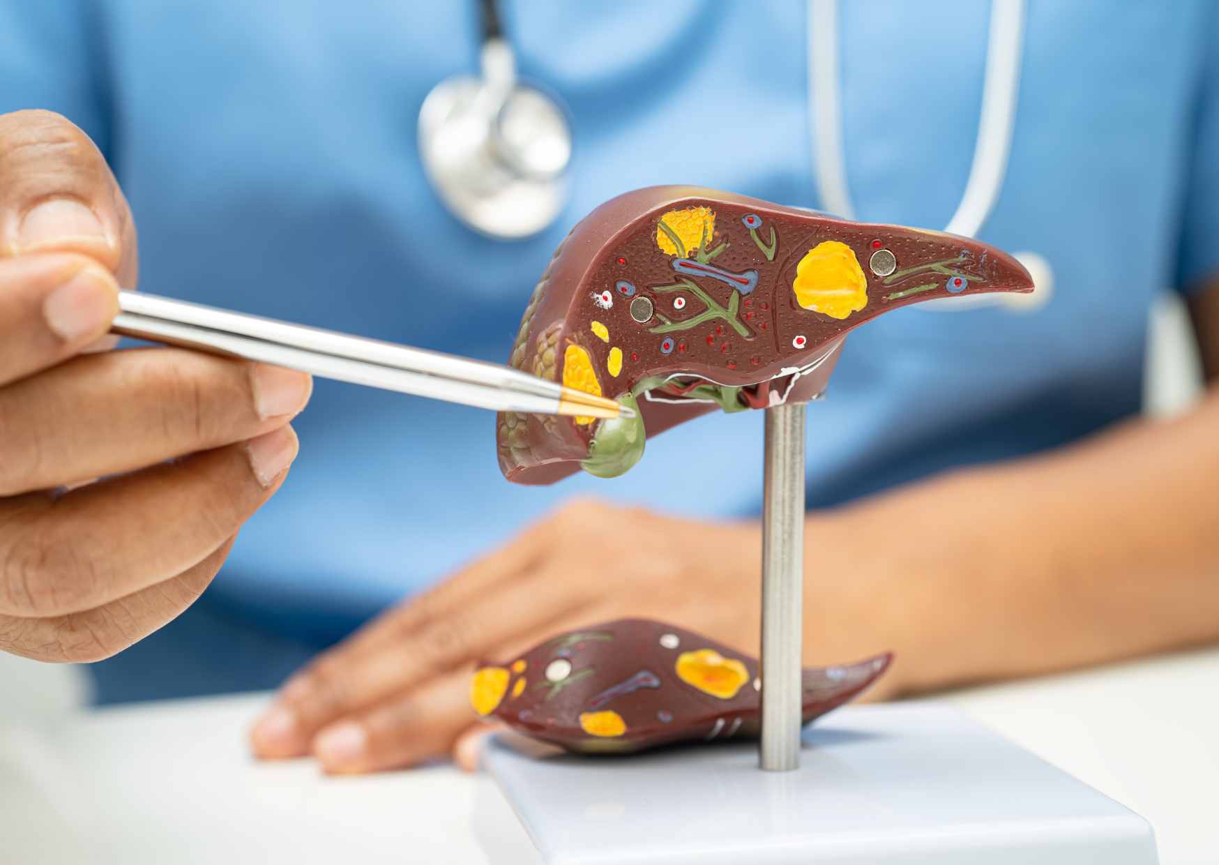 हेपाटोसेल्युलर कार्सिनोमा में miR-29b-DNMT3B-MTSS1 अक्ष को नियंत्रित करने में ताइवान ओलिगो फुकोइडन की भूमिका